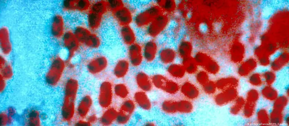 Yersinia pestis é causadora da peste pneumônica e da peste bubônica — Foto: picture-alliance/BSIP/J. Cavallini